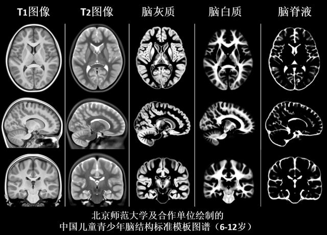 6北師大及合作單位繪制的中國兒童青少年腦結(jié)構(gòu)標(biāo)準(zhǔn)模板圖譜.png